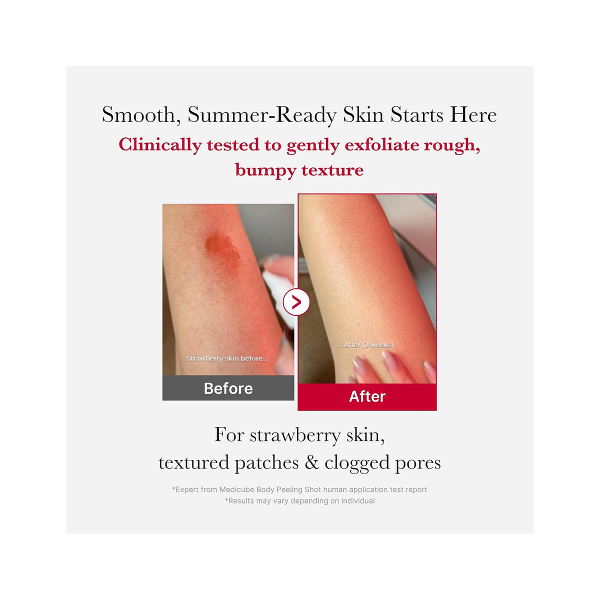Red Acne Body Peeling Shot MEDICUBE