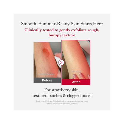Red Acne Body Peeling Shot MEDICUBE