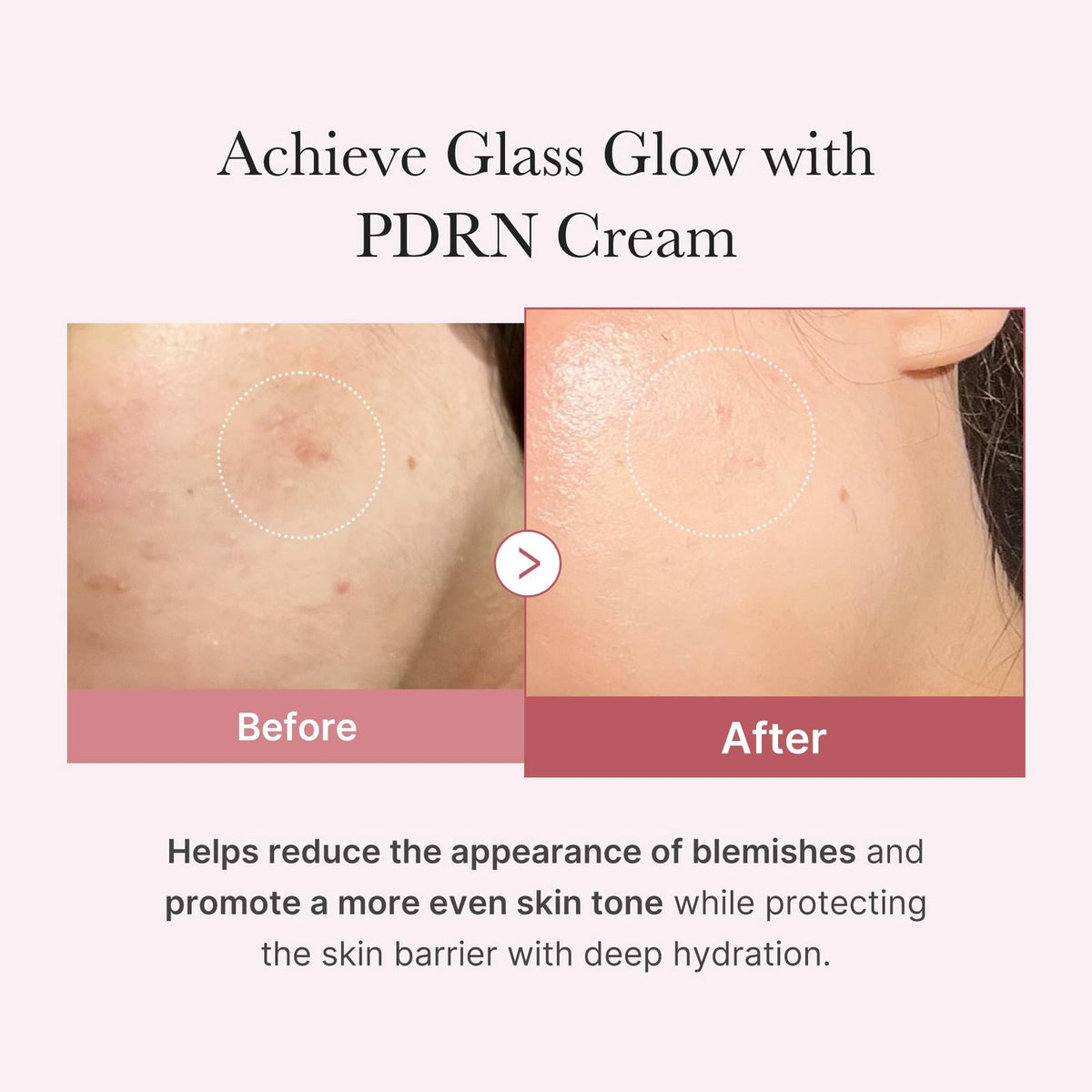 PDRN Pink Hyaluronic Moisturizing Cream 50 ML