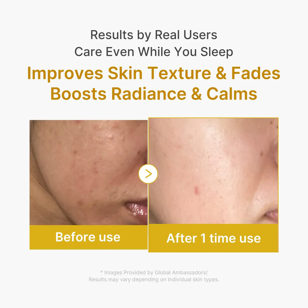 Kojic Acid Turmeric Night Wrapping Mask 75 ML MEDICUBE