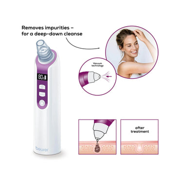 Beurer Power deep pore cleanser BEURER